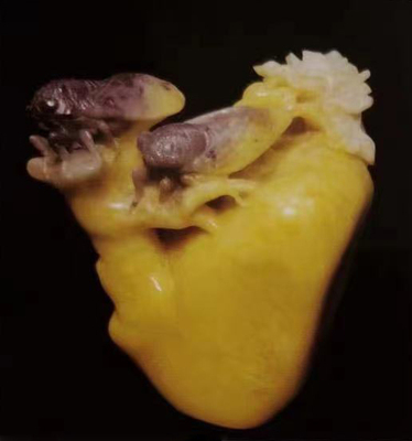 蝉
